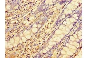 Immunohistochemistry of paraffin-embedded human colon tissue using ABIN7151556 at dilution of 1:100 (ELOVL1 antibody  (AA 82-175))