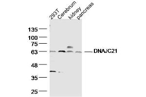 Lane 1: HT29 Cell lysates; Lane 2: mouse Cerebrum Cell lysates; Lane 3: Mouse kidney lysates; Lane 4: Mouse pancreas lysates; probed with DNAJC21 Polyclonal Antibody, unconjugated (bs-14387R) at 1:300 overnight at 4°C followed by a conjugated secondary antibody for 60 minutes at 37°C.
