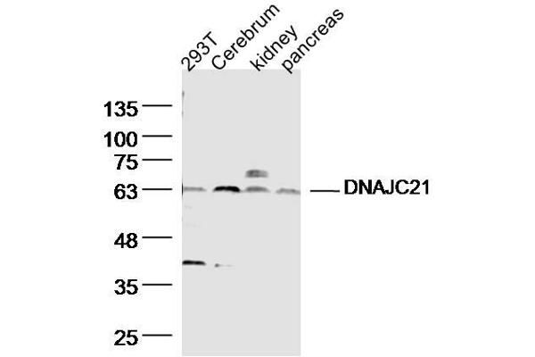 DNAJC21 抗体  (AA 11-120)