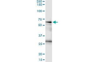 Immunoprecipitation of CSTF2 transfected lysate using rabbit polyclonal anti-CSTF2 and Protein A Magnetic Bead