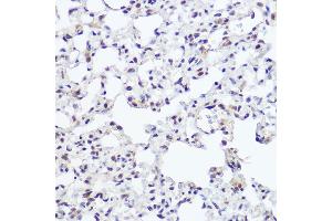 Immunohistochemistry of paraffin-embedded rat lung using NFIB Rabbit pAb (ABIN7268973) at dilution of 1:250 (40x lens). (NFIB antibody  (C-Term))