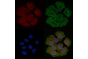 ABIN6258569 and ABIN6275581 staining Hela cells(30 min of UV treatment) by IF/ICC.