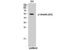 Western Blotting (WB) image for anti-Vimentin (VIM) (pSer83) antibody (ABIN3182647) (Vimentin antibody  (pSer83))