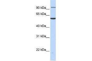 WB Suggested Anti-TNPO2 Antibody Titration: 0. (TNPO2 antibody  (N-Term))