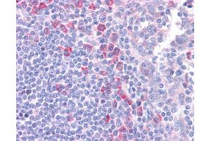 DLL1 antibody was used for immunohistochemistry at a concentration of 4-8 ug/ml. (DLL1 antibody)