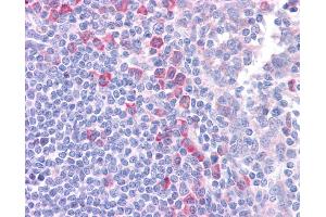 DLL1 antibody was used for immunohistochemistry at a concentration of 4-8 ug/ml. (DLL1 antibody)