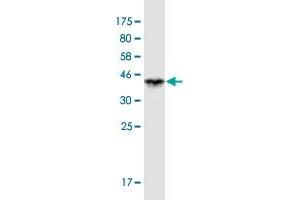 Western Blot detection against Immunogen (36. (VPS33B antibody  (AA 1-100))