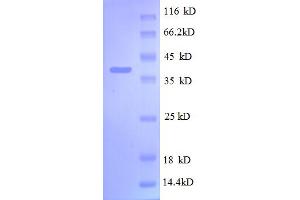 Ribosomal Protein S13 (RPS13) (AA 2-118) protein (GST tag)