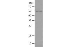 Western Blotting (WB) image for MORC Family CW-Type Zinc Finger 3 (MORC3) (AA 1-290) protein (His-IF2DI Tag) (ABIN7287177) (MORC3 Protein (AA 1-290) (His-IF2DI Tag))