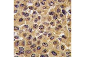 Immunohistochemistry (IHC) image for anti-Cell Division Cycle 25 Homolog B (S. Pombe) (CDC25B) (AA 331-360) antibody (ABIN3030451)