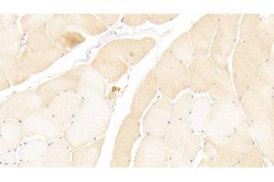 Detection of MMP1 in Human Skeletal muscle Tissue using Polyclonal Antibody to Matrix Metalloproteinase 1 (MMP1) (MMP1 antibody  (AA 98-275))