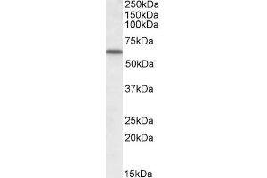 ABIN570924 (1µg/ml) staining of Human Lung lysate (35µg protein in RIPA buffer). (Vitamin D-Binding Protein antibody  (AA 18-30))