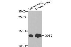 Western blot analysis of extracts of various cell lines, using G0S2 Antibody. (G0S2 antibody)