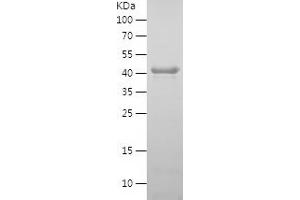 SIRT2 Protein (AA 2-389) (His tag)