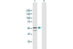 Western Blot analysis of GNAL expression in transfected 293T cell line by GNAL MaxPab polyclonal antibody. (GNAL antibody  (AA 1-458))