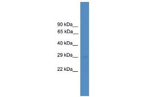 WB Suggested Anti-UBTD1 Antibody Titration: 0. (UBTD1 antibody  (Middle Region))