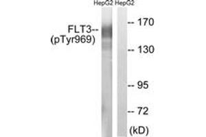 Western blot analysis of extracts from HepG2 cells treated with Na3VO4 0. (FLT3 antibody  (pTyr969))
