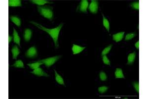 Immunofluorescence of purified MaxPab antibody to DPF2 on HeLa cell. (DPF2 antibody  (AA 1-391))