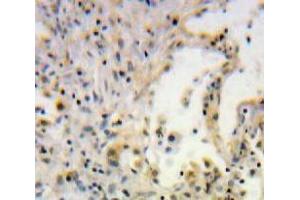 #VALUE! (SCGB1A1 antibody  (AA 21-96))