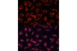 Immunofluorescence analysis of C6 cells using PDH Polyclonal Antibody (ABIN6132882, ABIN6145379, ABIN6145381 and ABIN6225274) at dilution of 1:100 (40x lens). (PDHA2 antibody  (AA 119-388))
