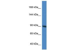 WB Suggested Anti-Rasa1 Antibody   Titration: 1. (RASA1 antibody  (C-Term))
