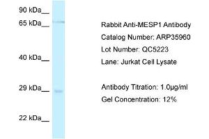WB Suggested Anti-MESP1 Antibody   Titration: 1. (MESP1 antibody  (C-Term))