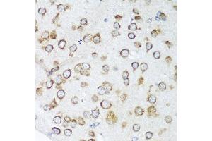 Immunohistochemistry of paraffin-embedded mouse brain using NOTCH2 antibody at dilution of 1:100 (40x lens).