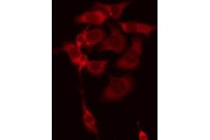 ABIN6278591 staining Hela by IF/ICC. (C18orf8 antibody  (C-Term))
