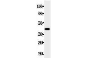 Anti-HSD17B2 antibody, Western blotting All lanes: Anti HSD17B2  at 0. (HSD17B2 antibody  (C-Term))