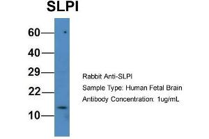 Host: Rabbit  Target Name: SLPI  Sample Tissue: Human Fetal Brain  Antibody Dilution: 1. (SLPI antibody  (N-Term))
