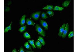 Immunofluorescent analysis of A549 cells using ABIN7168384 at dilution of 1:100 and Alexa Fluor 488-congugated AffiniPure Goat Anti-Rabbit IgG(H+L) (NOB1 antibody  (AA 103-229))