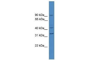 Western Blot showing SERPINE1 antibody used at a concentration of 1-2 ug/ml to detect its target protein. (PAI1 antibody  (N-Term))