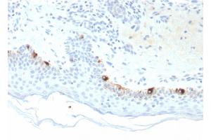 Formalin-fixed, paraffin-embedded human Skin stained with TYRP1-Monospecific Mouse Monoclonal Antibody (TYRP1/3281).