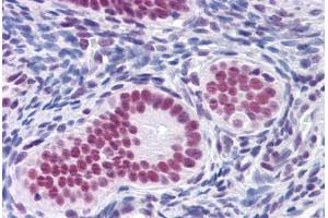Human Uterus: Formalin-Fixed, Paraffin-Embedded (FFPE) (RUNX2 antibody  (AA 251-351))