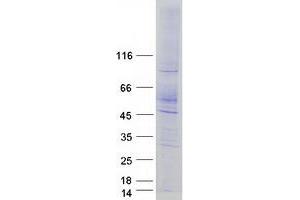 Validation with Western Blot