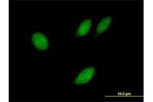 Immunofluorescence of purified MaxPab antibody to TXNL4B on HeLa cell. (TXNL4B antibody  (AA 1-149))