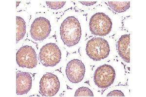 IHC analysis of WWOX using anti-WWOX antibody (ABIN6719627). (WWOX antibody  (AA 1-245))