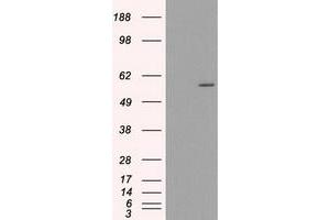 HEK293T cells were transfected with the pCMV6-ENTRY control (Left lane) or pCMV6-ENTRY CYP2E1 (Right lane) cDNA for 48 hrs and lysed. (CYP2E1 antibody)