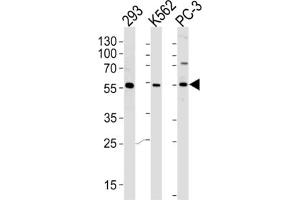Western Blotting (WB) image for anti-Phosphatidylinositol-4-Phosphate 5-Kinase-Like 1 (PIP5KL1) antibody (ABIN2996126) (PIP5KL1 antibody)