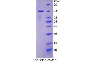 SDS-PAGE analysis of Human Keratin 7 Protein. (Cytokeratin 7 Protein)