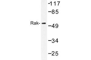 Image no. 1 for anti-Fyn-Related Kinase (FRK) antibody (ABIN272190) (FRK antibody)