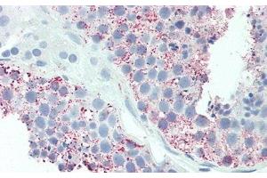 Detection of UCN2 in Human Testis Tissue using Polyclonal Antibody to Urocortin 2 (UCN2) (Urocortin 2 antibody  (AA 23-107))