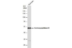 WB Image Carboxypeptidase M antibody [N1C2] detects Carboxypeptidase M protein by western blot analysis.