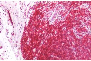 Immunohistochemistry staining of human tonsil (paraffin-embedded sections) with anti-CD45RA (MEM-56), 5 μg/mL. (CD45RA antibody)