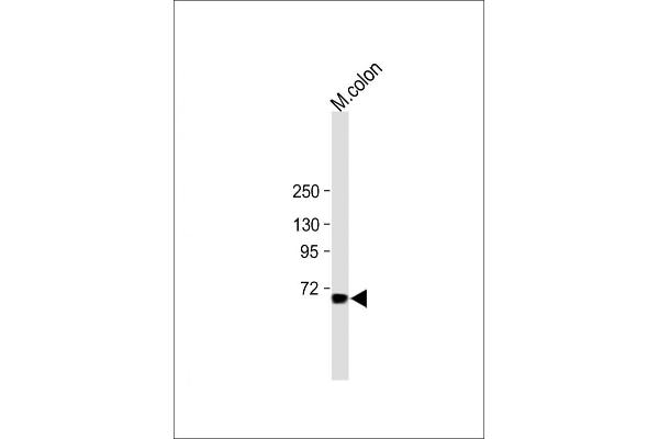 ESRP1 Antikörper  (AA 182-211)