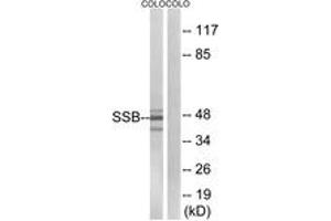 Western blot analysis of extracts from COLO cells, using SSB (Ab-366) Antibody. (SSB antibody  (AA 341-390))