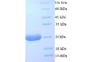 SDS-PAGE (SDS) image for Complement Component 1, Q Subcomponent, A Chain (C1QA) (AA 23-245) protein (His tag) (ABIN5713294) (C1QA Protein (AA 23-245) (His tag))