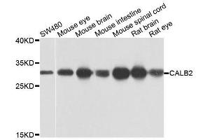 Western blot analysis of extracts of various cell lines, using CALB2 antibody (ABIN6003539) at 1/1000 dilution. (Calretinin antibody)