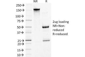 SDS-PAGE Analysis Purified Desmoglein-3 Monoclonal Antibody (5G11). (Desmoglein 3 antibody)