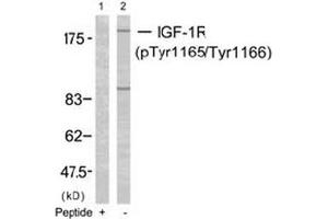 Image no. 2 for anti-Insulin-Like Growth Factor 1 Receptor (IGF1R) (pTyr1165), (pTyr1166) antibody (ABIN196774) (IGF1R antibody  (pTyr1165, pTyr1166))
